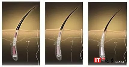 绝不能输在发际线上,如何吃出乌黑秀发 | 生活方式